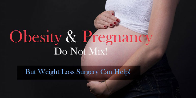 جراحی چاقی و اثر مفید آن در دوران حاملگی