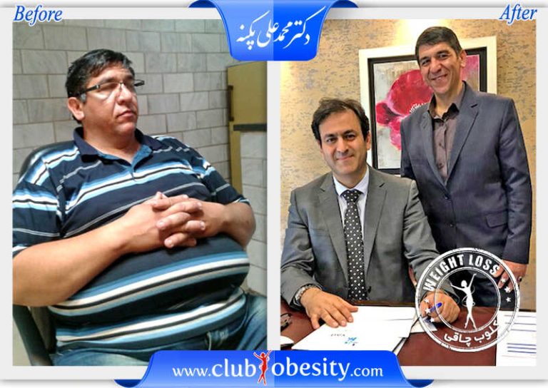 بای پس کلاسیک معده