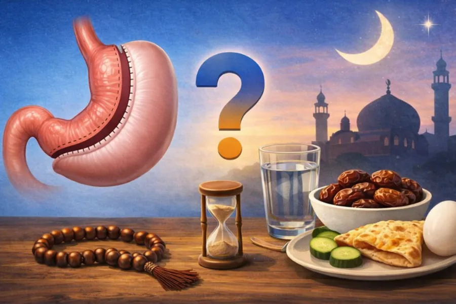 آیا روزه گرفتن بعد از جراحی اسلیو و بای_پس معده مجاز است؟