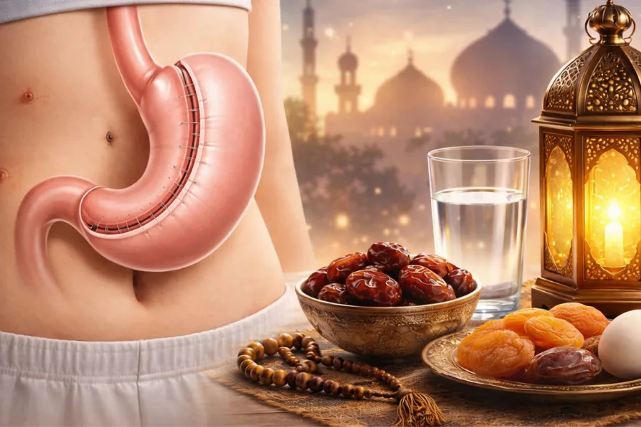 رژیم غذایی مناسب برای روزه گرفتن بعد از اسلیو و بای_پس
