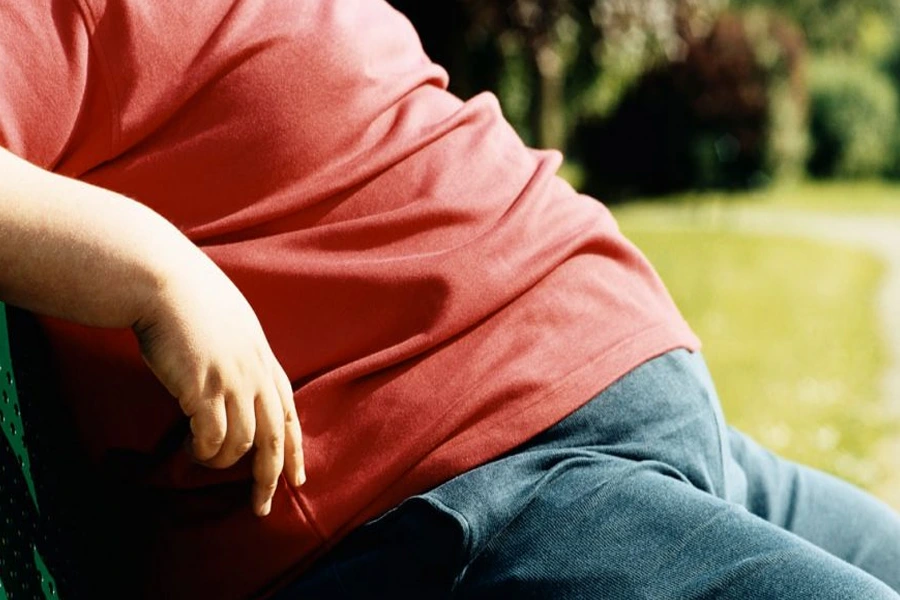 جراحی اسلیو معده (Sleeve Gastrectomy)