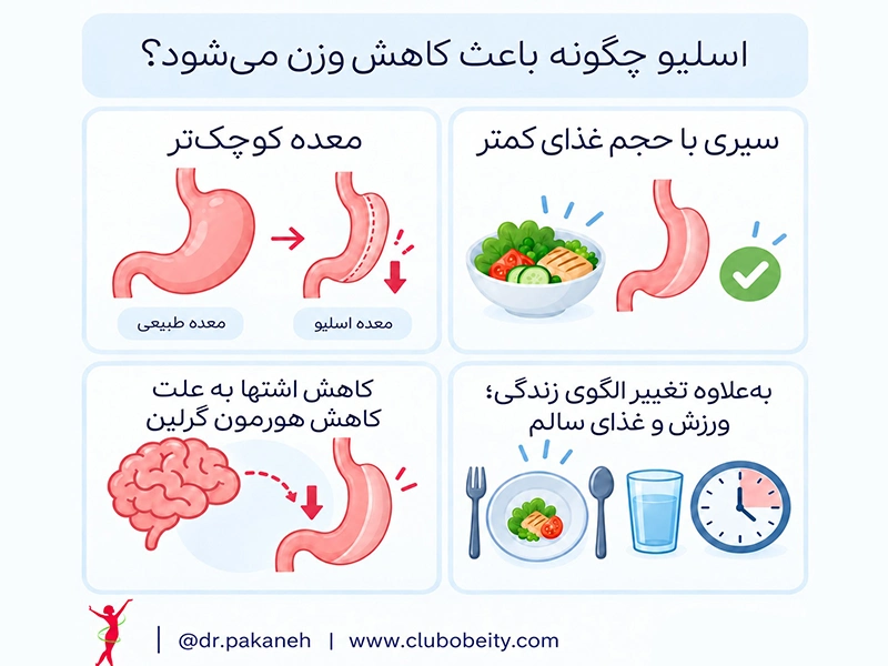 اسلیو معده چگونه باعث کاهش وزن می‌شود؟