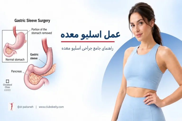 عمل اسلیو معده
